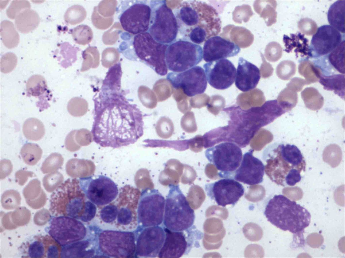 Bone marrow aspirate, 60X